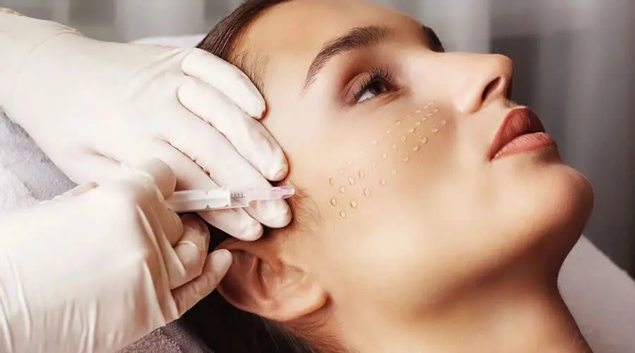 لاین مزوتراپی