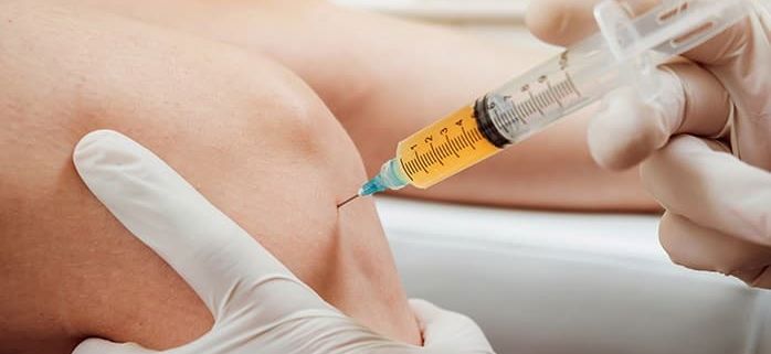 PRP زانو و مفاصل 